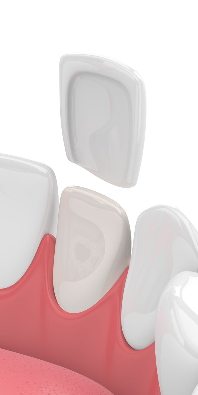 Optima Dental Care