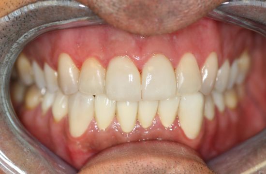 After -Optima Dental Care