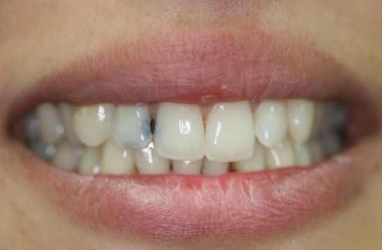Before -Optima Dental Care