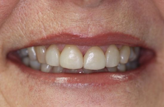 After -Optima Dental Care