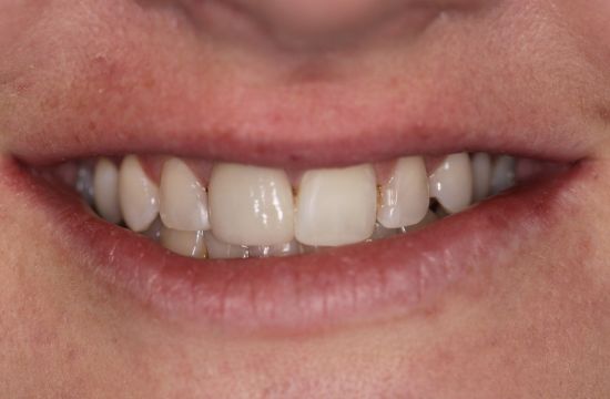 After -Optima Dental Care