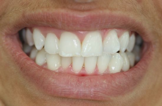 After -Optima Dental Care