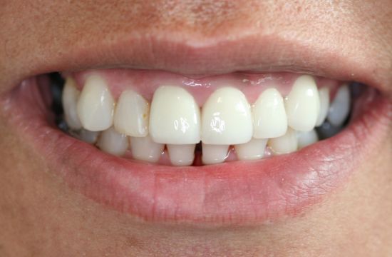 After -Optima Dental Care
