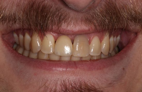 After -Optima Dental Care