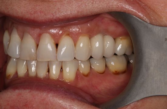 After -Optima Dental Care