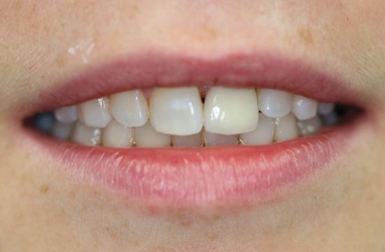 After -Optima Dental Care