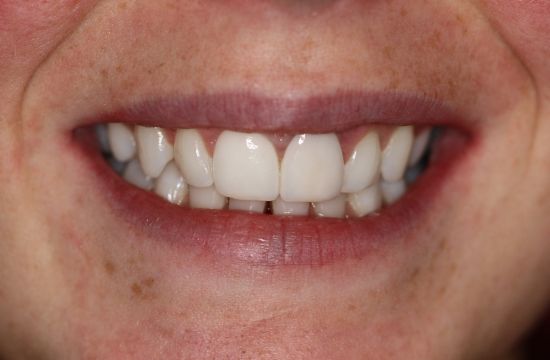 After -Optima Dental Care