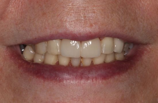 After -Optima Dental Care