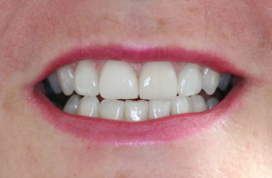 After -Optima Dental Care