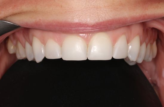 After -Optima Dental Care