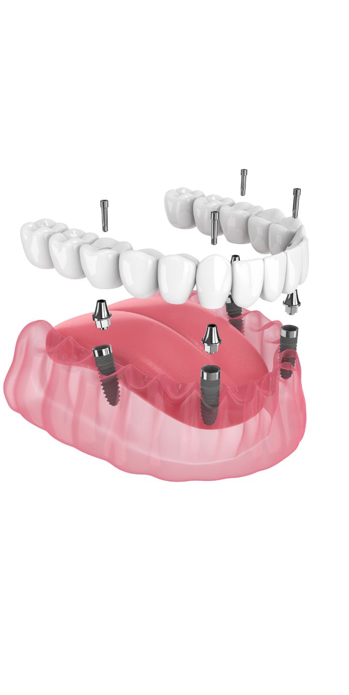 Optima Dental Care