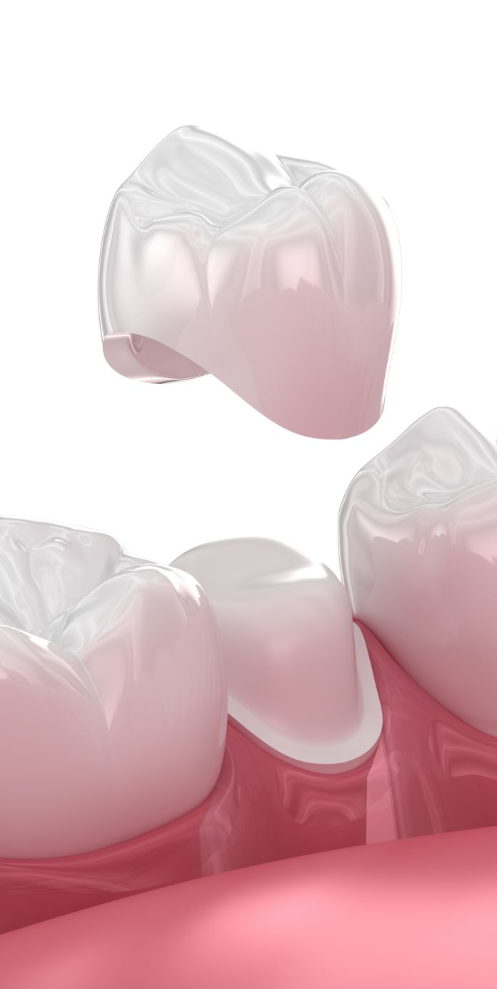 Optima Dental Care