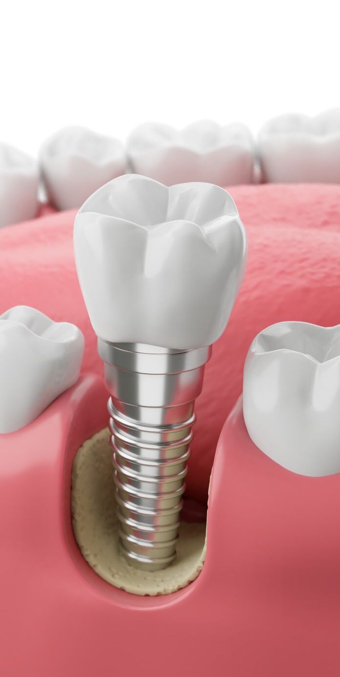 Optima Dental Care