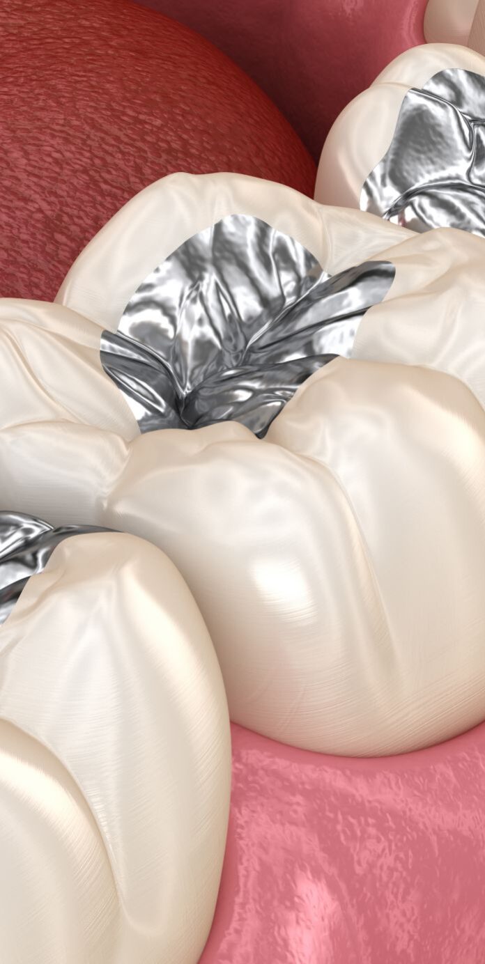 Optima Dental Care