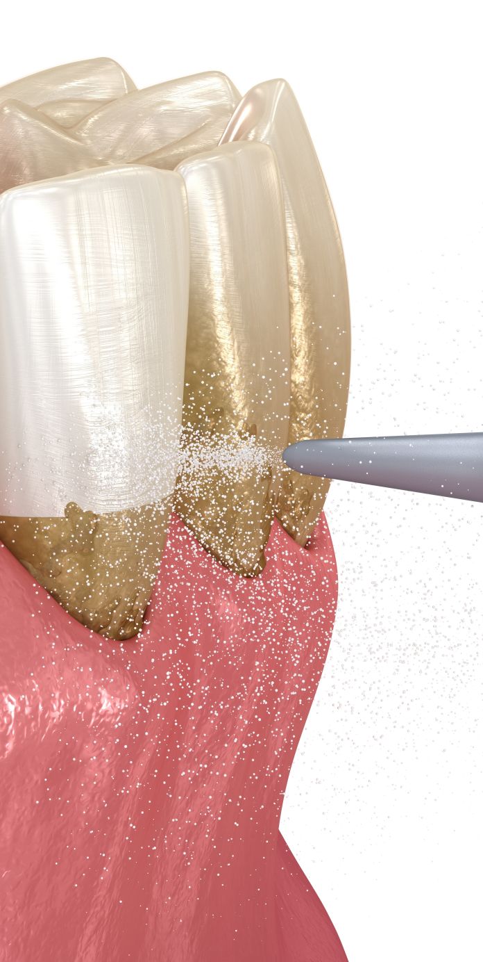 Optima Dental Care