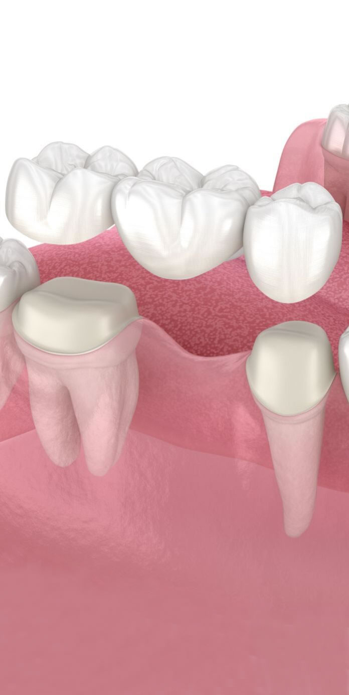 Optima Dental Care