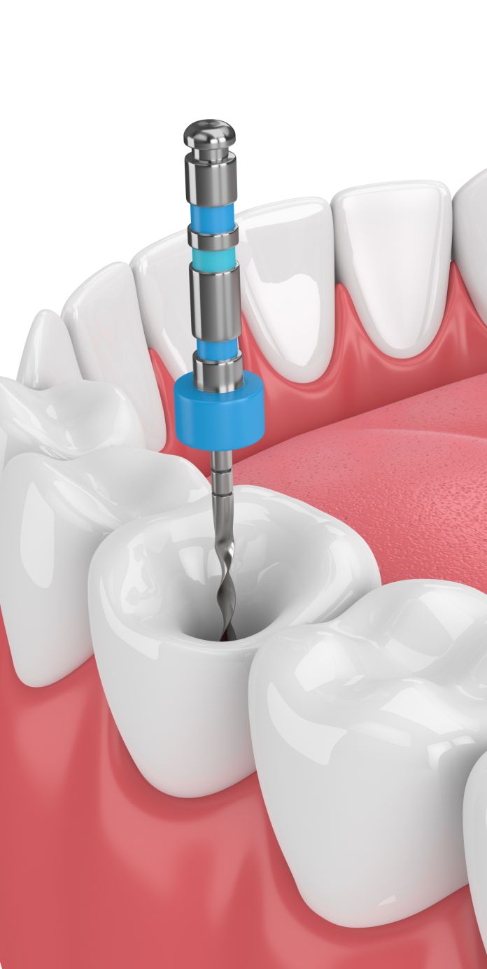 Optima Dental Care