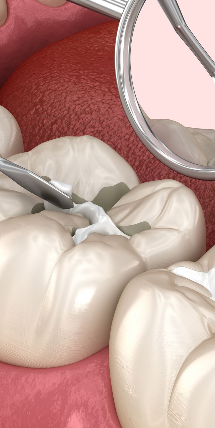 Optima Dental Care