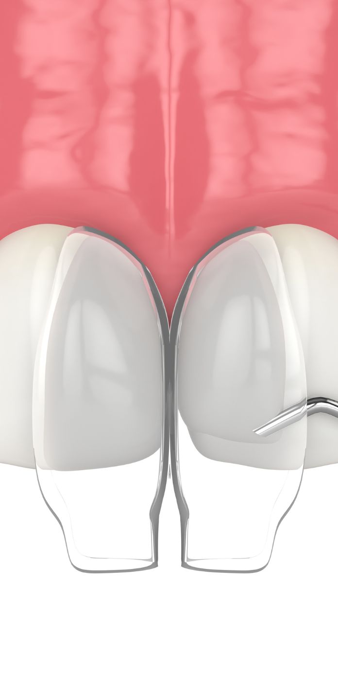 Optima Dental Care