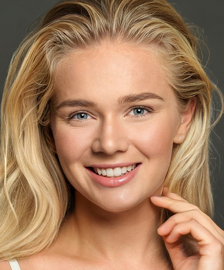 Transformation - Optima Dental Care